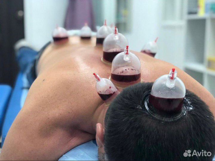 Хиджама (обучение )