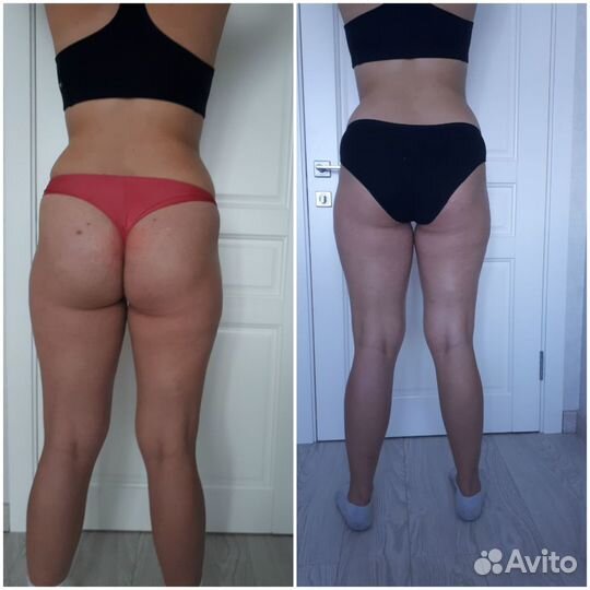 Услуги спа-эстетиста, массаж