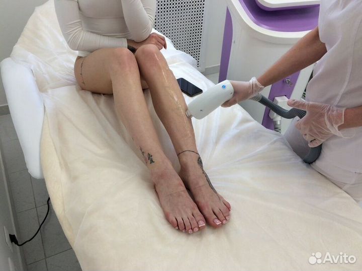 Франшиза лазерной эпиляции – выгодный старт