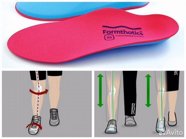 Изготовление индивидуальных ортопедических стелек