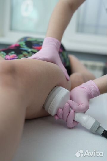 Аппаратный вакуумный массаж