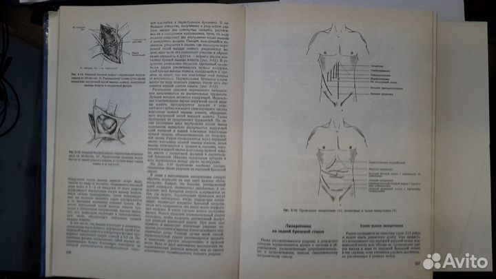 Оперативная хирургия проф. И. Литтманна