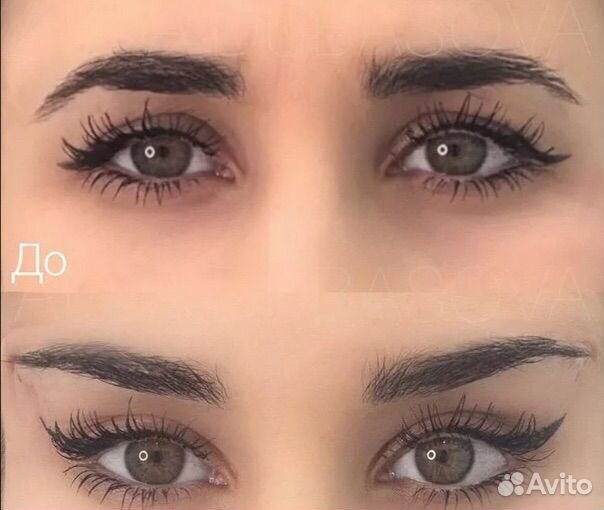 Тейпы для глаз многоразовые (лисьи глазки )