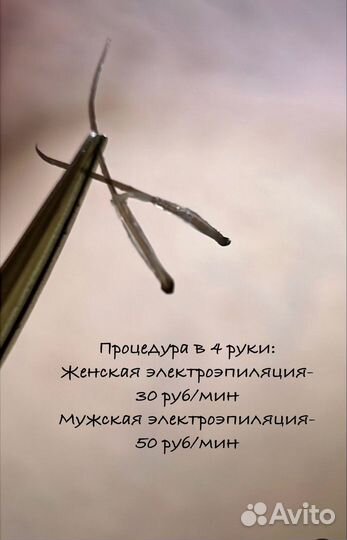 Электроэпиляция