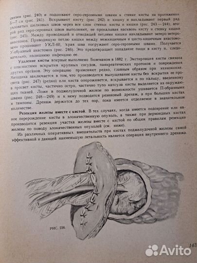 Атлас хирургических операций А.А.Шалимов