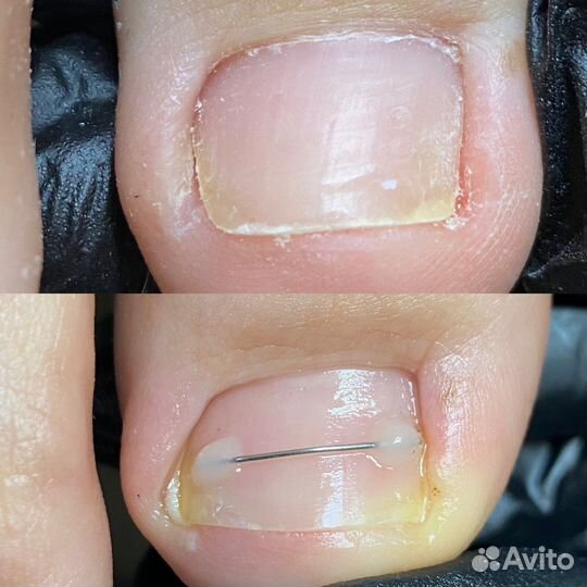 Подолог педикюр подология