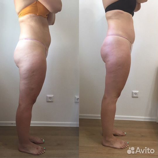 Массаж лица и тела