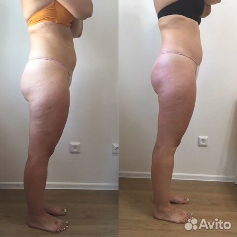 Массаж лица и тела