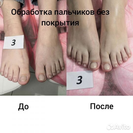 Маникюр, педикюр