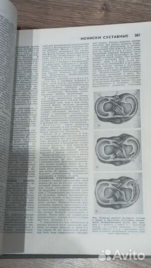 Популярная медицинская энциклопедия 1988г