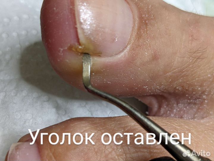 Услуги подолога