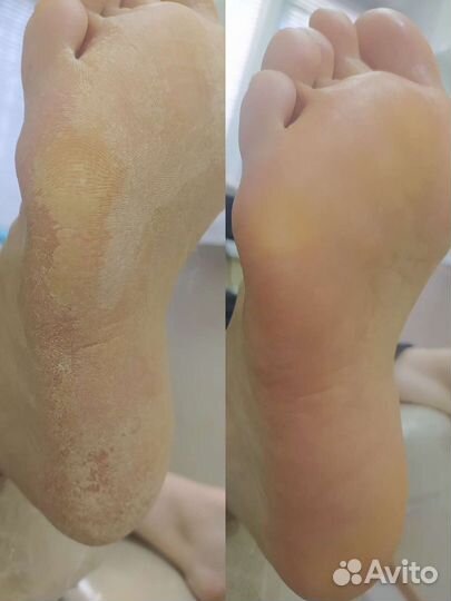 Подолог, педикюр