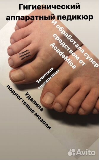 Шугаринг, педикюр, подология