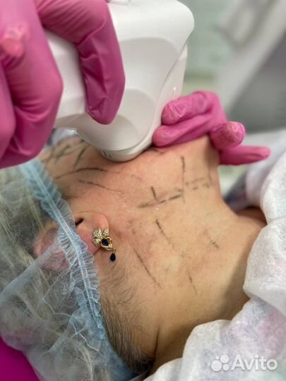 Аппараты для косметологии (все виды)