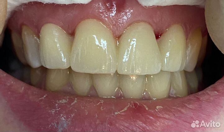 Зубной техник