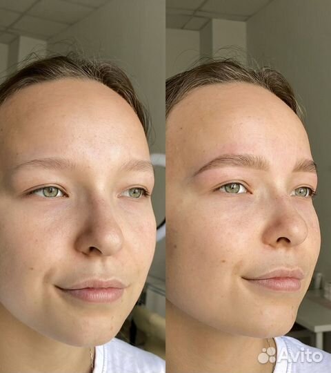 Брови Бугры