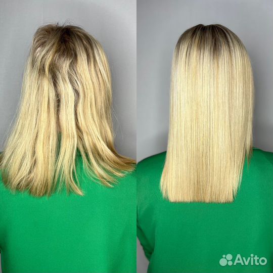 Ботокс, биксипластия,пилинг кожи. Провожу обучение