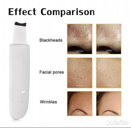 Ультразвуковой скрабер новый