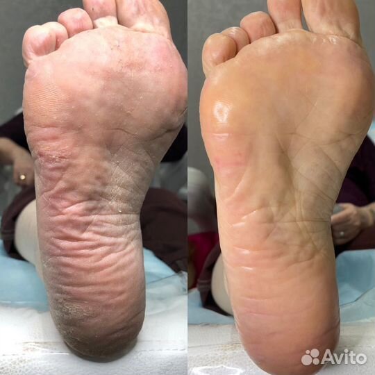 Педикюр, Подолог