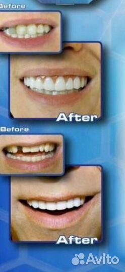 Виниры для зубов perfect smile veneer