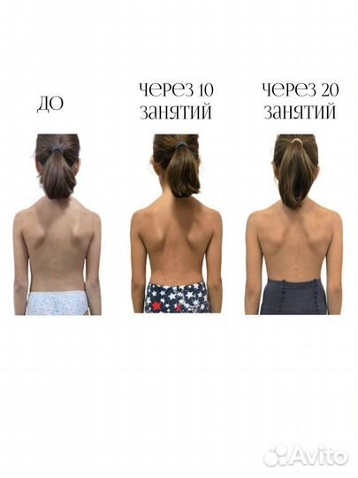 Коррекционная гимнастика