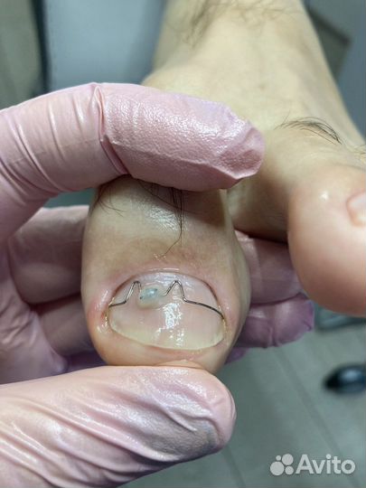 Услуги подолога