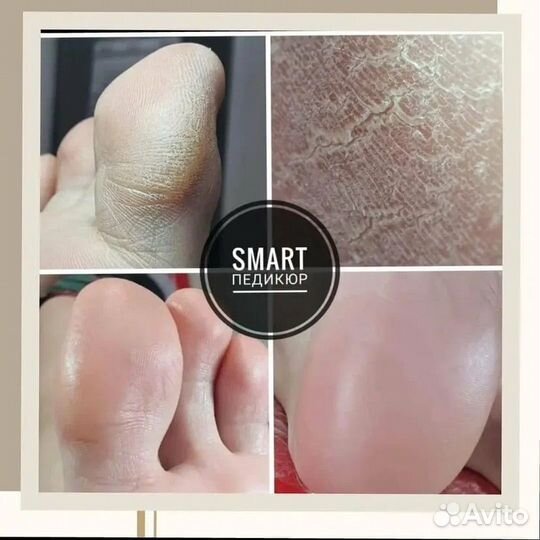 Педикюр, смарт педикюр