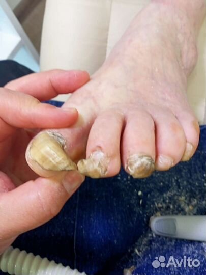 Выезд на дом.Педикюр пожылым.Медицинский педикюр