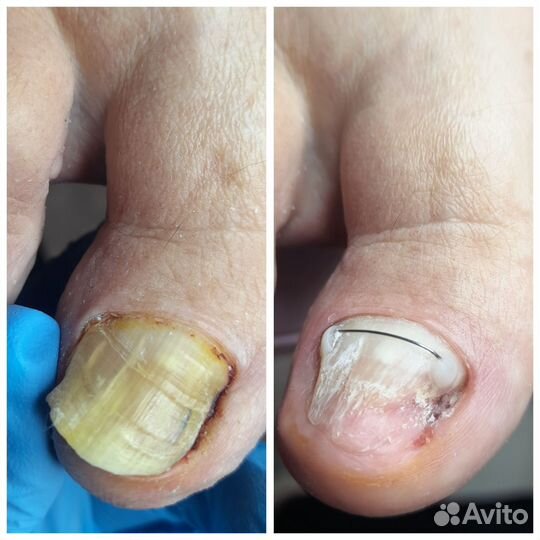 Услуги подолога