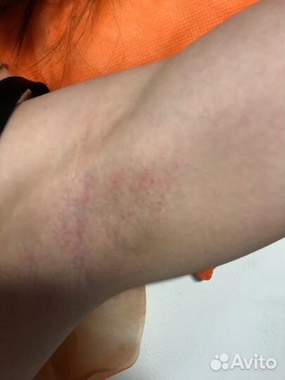 Восковая депиляция