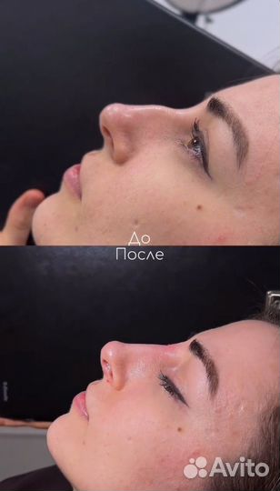 Услуги косметолога