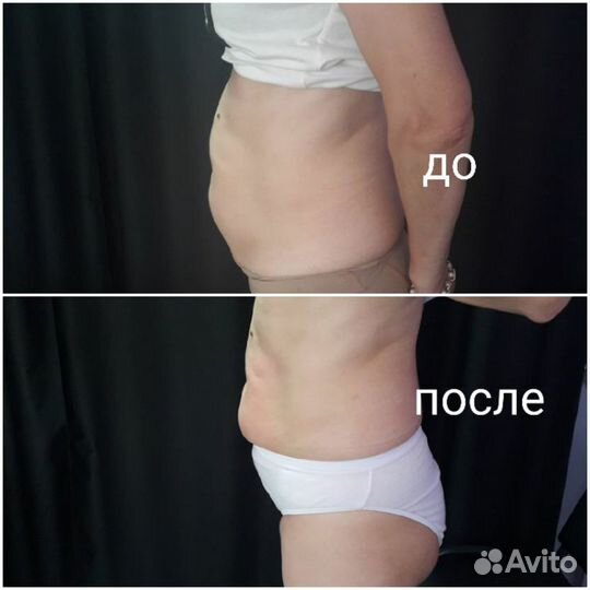 Аппаратный и ручной массаж