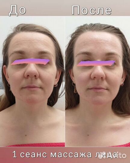 Миофасциальный + скульптурный массаж лица