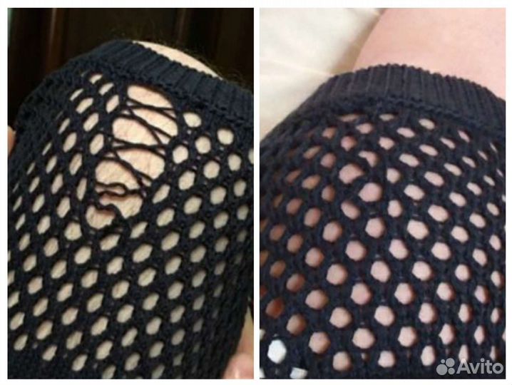 Ремонт трикотажных изделий