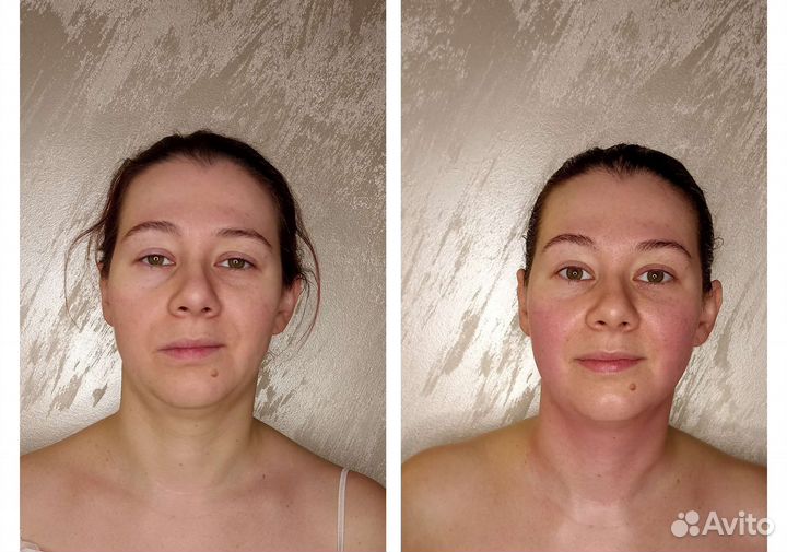 Массаж, ручная липопластика