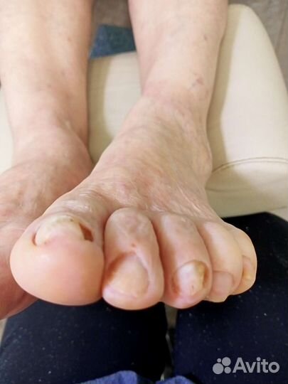 Выезд на дом.Педикюр пожылым.Медицинский педикюр