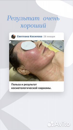 Запись на процедуры