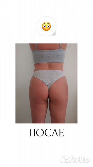 Ультразвуковая Кавитация,быстрое похудение