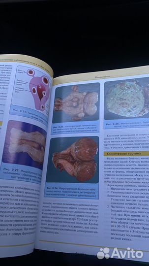 Книга/учебник по гинекологии
