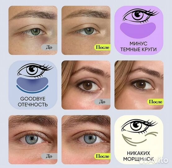 Vois патчи для глаз с коллагеном гидрогелевые