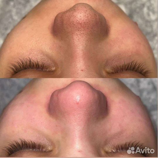 Маникюр, педикюр, косметолог, депиляция