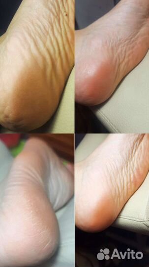 Педикюр (смарт) маникюр, покрытие гель лак