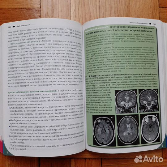 Топический диагноз в неврологии по Петеру Дуусу