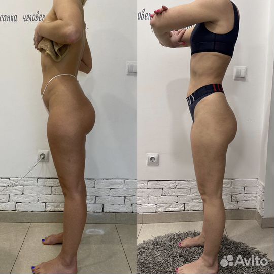 Коррекция фигуры