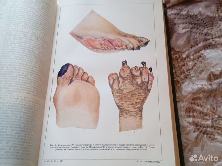 Военная медицина,советская медицина 1941-1945 г
