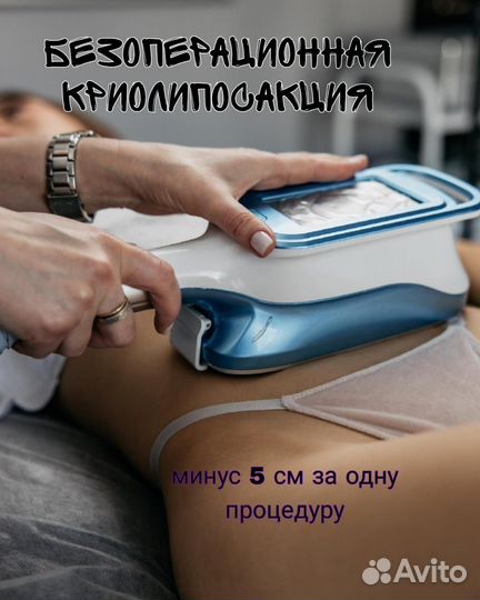 Криолипосакция криолиполиз