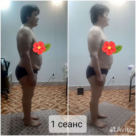 Биоэнергомассаж