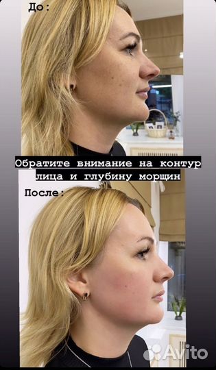 Массаж лица