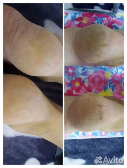 Маникюр, наращивание ногтей, Smart педикюр