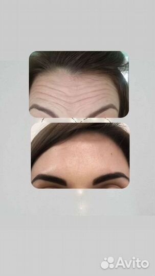 Массажистка, врач косметолог